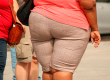 obezite sismanligin tanimi nedenleri