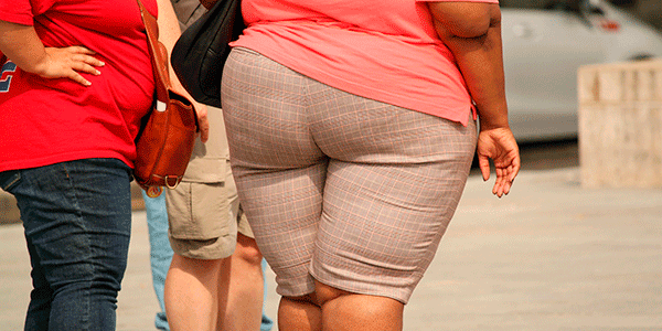 obezite sismanligin tanimi nedenleri